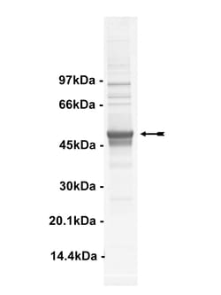 Eurofins DiscoverX DDR2 Protein, Active:Recombinant Proteins